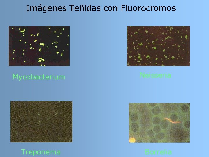 Imágenes Teñidas con Fluorocromos Mycobacterium Treponema Neisseria Borrelia Imágenes Teñidas con Fluorocromos Mycobacterium Treponema Neisseria Borrelia