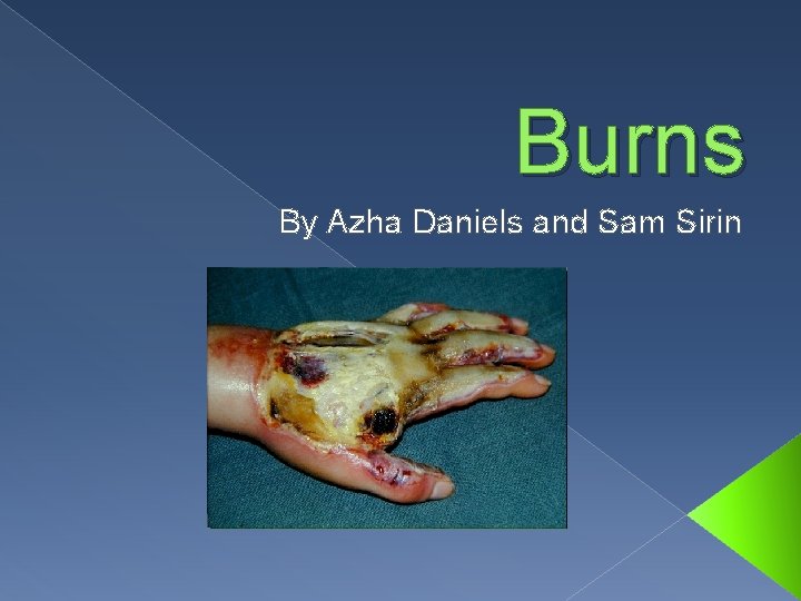 Burns By Azha Daniels and Sam Sirin 