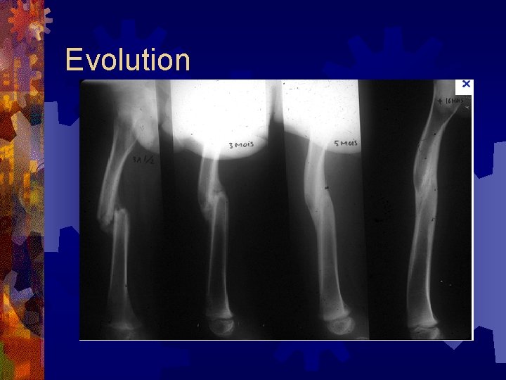 Evolution 