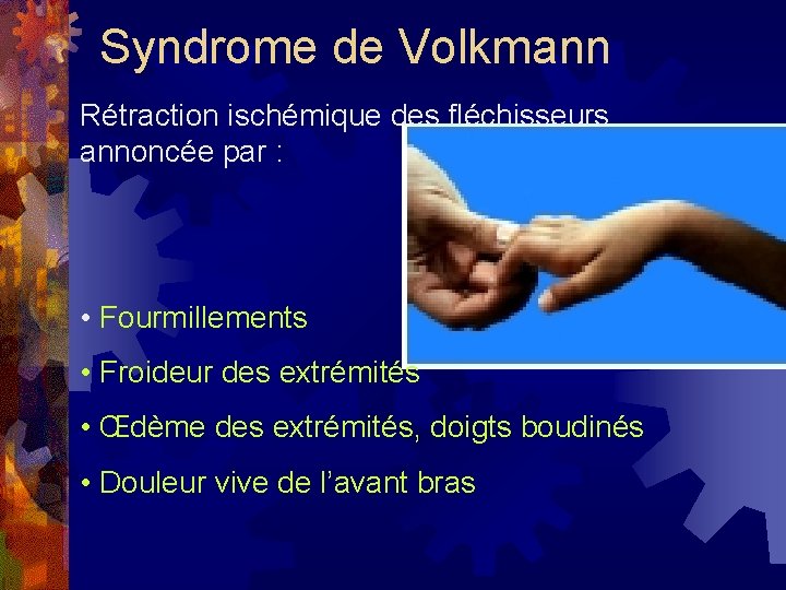 Syndrome de Volkmann Rétraction ischémique des fléchisseurs annoncée par : • Fourmillements • Froideur