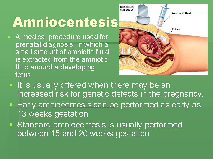 Amniocentesis § A medical procedure used for prenatal diagnosis, in which a small amount Amniocentesis § A medical procedure used for prenatal diagnosis, in which a small amount