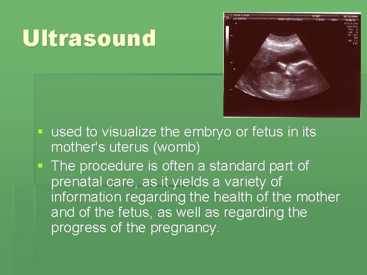 Ultrasound § used to visualize the embryo or fetus in its mother's uterus (womb) Ultrasound § used to visualize the embryo or fetus in its mother's uterus (womb)