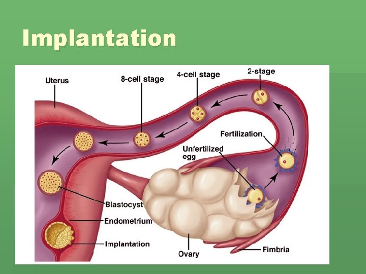 Implantation Implantation