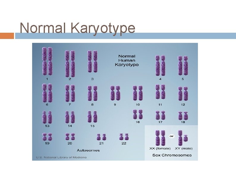 Normal Karyotype 