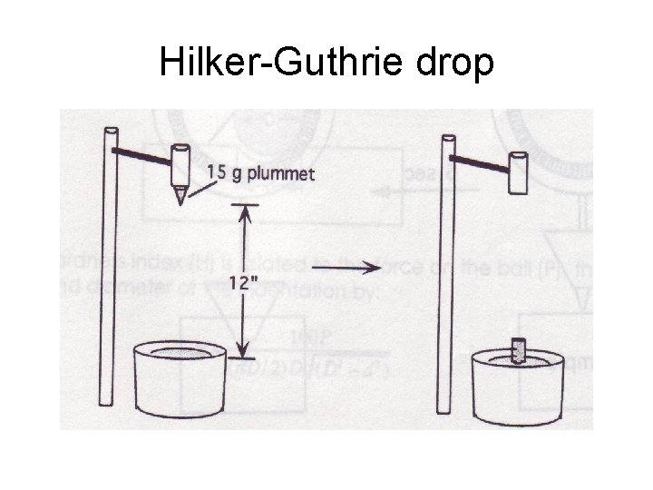 Hilker-Guthrie drop 