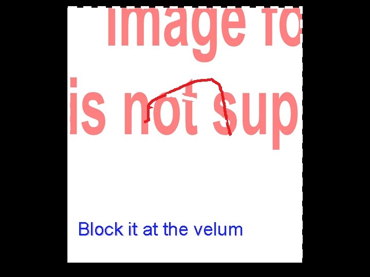 Block it at the velum 