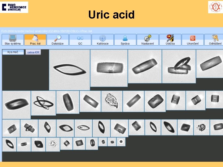 Uric acid 