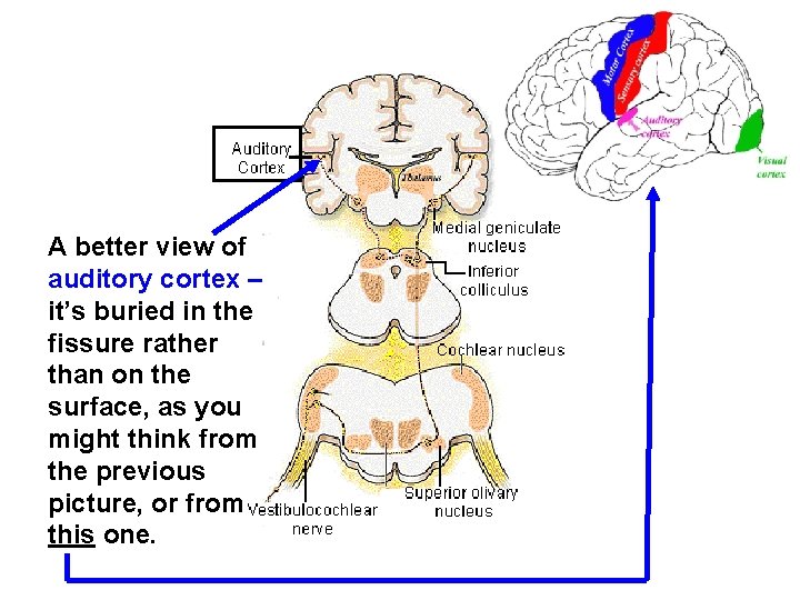 A better view of auditory cortex – it’s buried in the fissure rather than