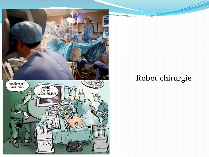 Robot chirurgie 