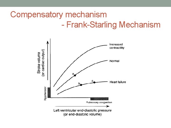 Compensatory mechanism - Frank-Starling Mechanism 