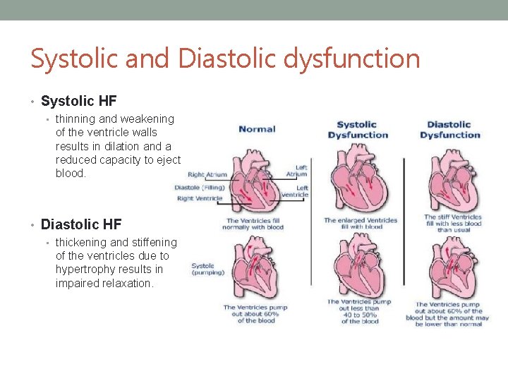 Systolic and Diastolic dysfunction • Systolic HF • thinning and weakening of the ventricle