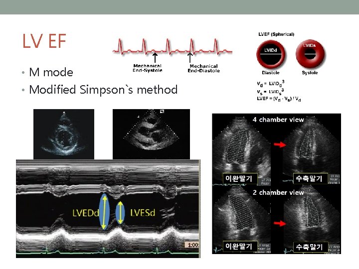 LV EF • M mode • Modified Simpson`s method 