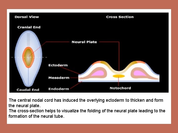 The central nodal cord has induced the overlying ectoderm to thicken and form the