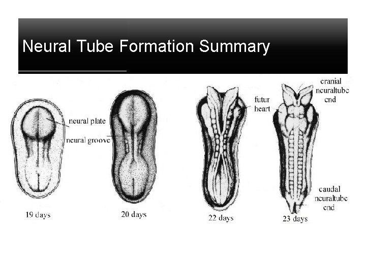 Neural Tube Formation Summary 