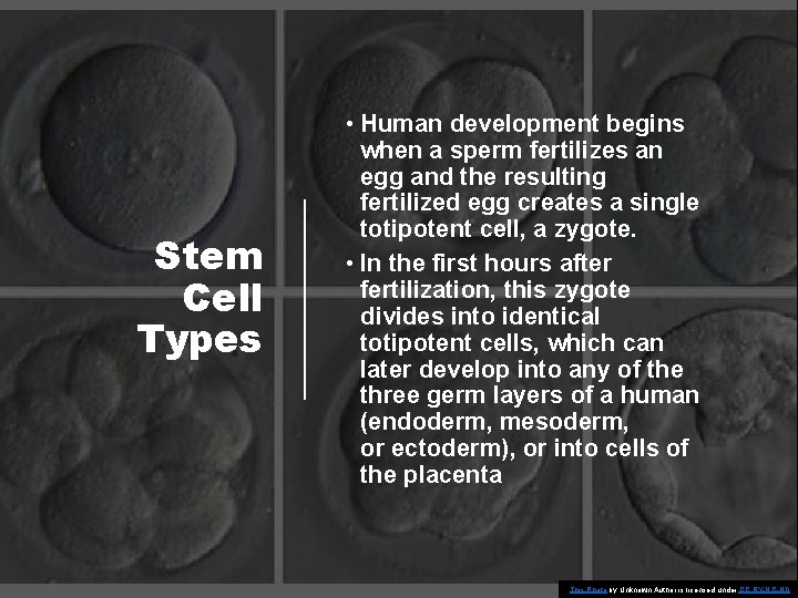 Stem Cell Types • Human development begins when a sperm fertilizes an egg and