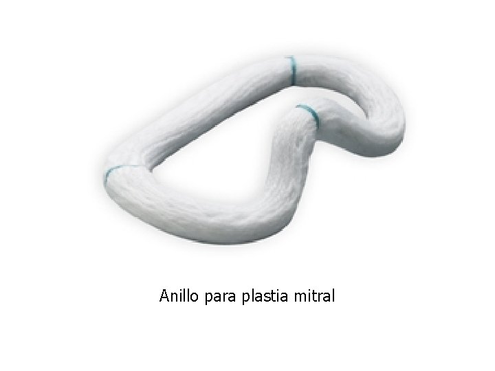 Anillo para plastia mitral 