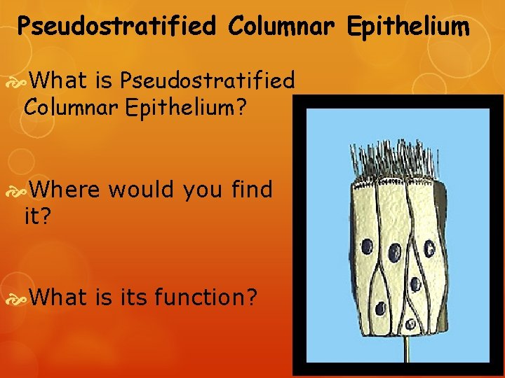 Pseudostratified Columnar Epithelium What is Pseudostratified Columnar Epithelium? Where would you find it? What