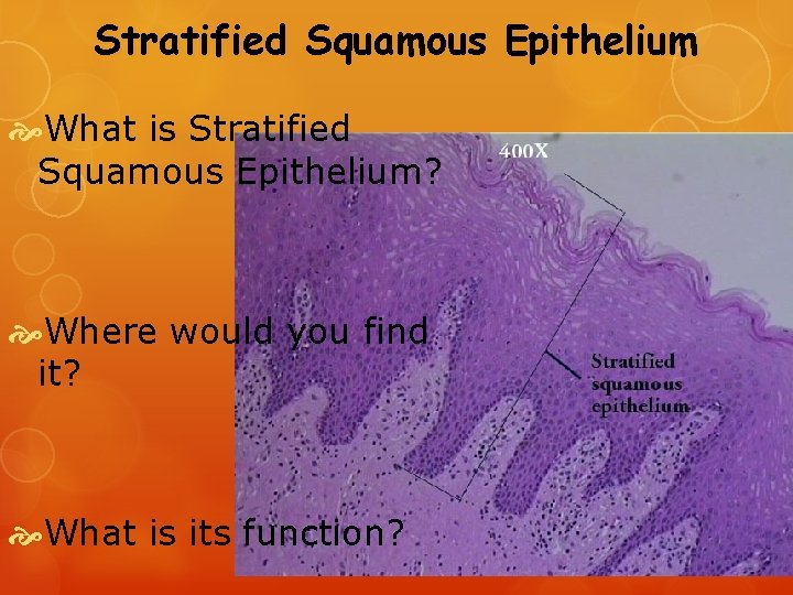 Stratified Squamous Epithelium What is Stratified Squamous Epithelium? Where would you find it? What