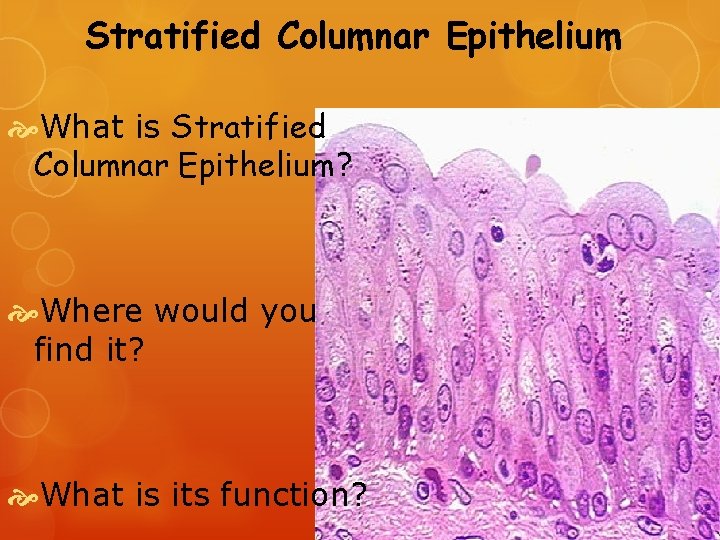 Stratified Columnar Epithelium What is Stratified Columnar Epithelium? Where would you find it? What
