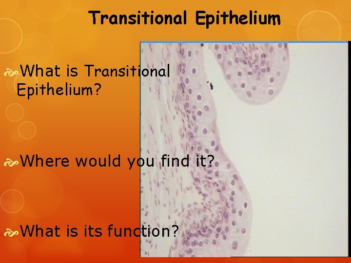 Transitional Epithelium What is Transitional Epithelium? Where would you find it? What is its