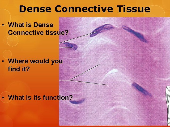 Dense Connective Tissue • What is Dense Connective tissue? • Where would you find
