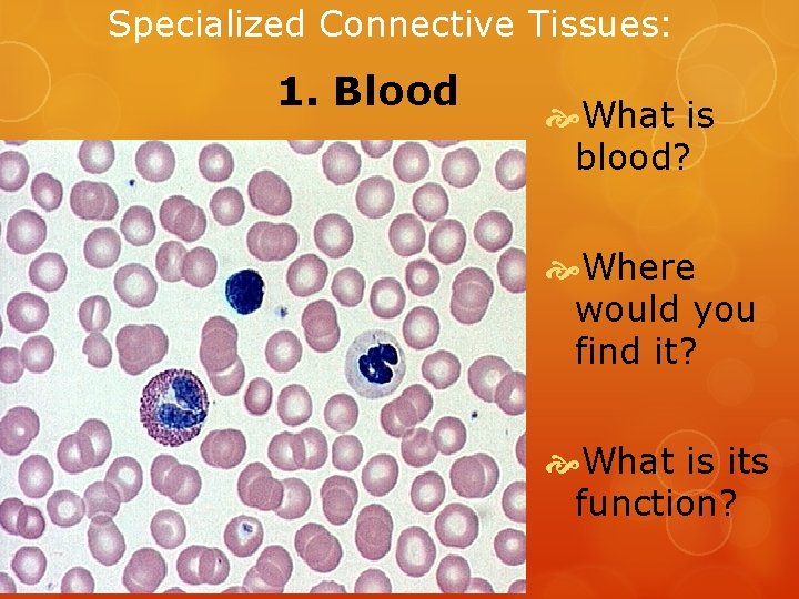 Specialized Connective Tissues: 1. Blood What is blood? Where would you find it? What