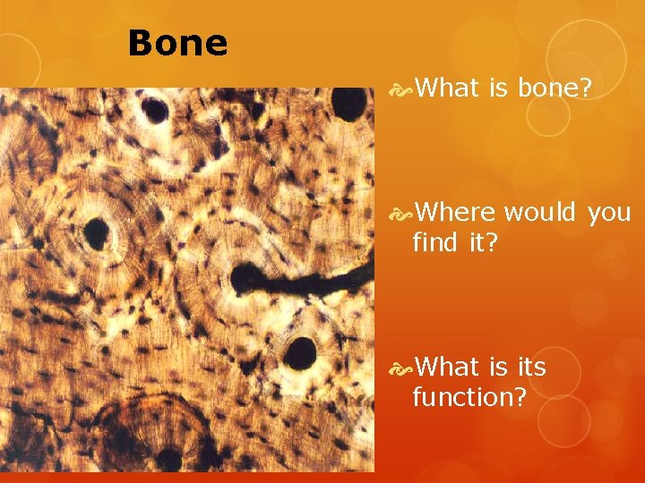 Bone What is bone? Where would you find it? What is its function? 
