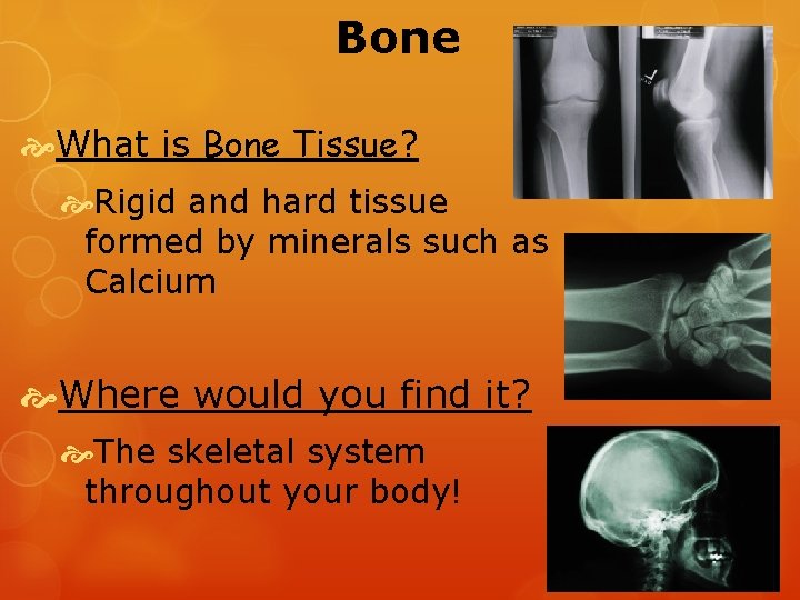 Bone What is Bone Tissue? Rigid and hard tissue formed by minerals such as