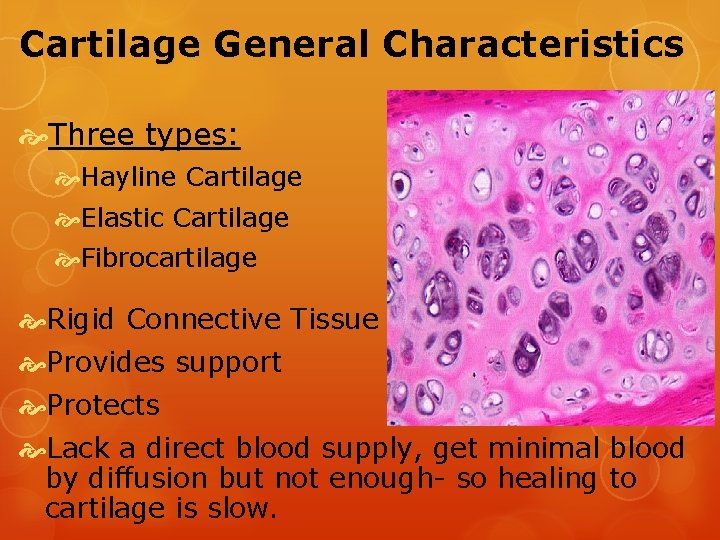 Cartilage General Characteristics Three types: Hayline Cartilage Elastic Cartilage Fibrocartilage Rigid Connective Tissue Provides