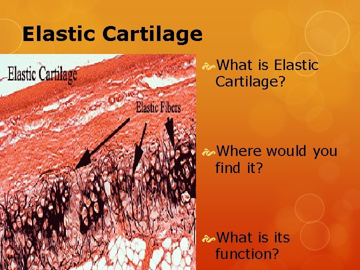 Elastic Cartilage What is Elastic Cartilage? Where would you find it? What is its