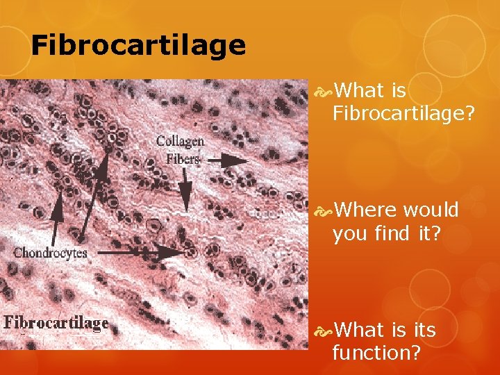 Fibrocartilage What is Fibrocartilage? Where would you find it? What is its function? 
