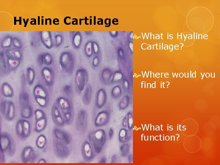 Hyaline Cartilage What is Hyaline Cartilage? Where would you find it? What is its