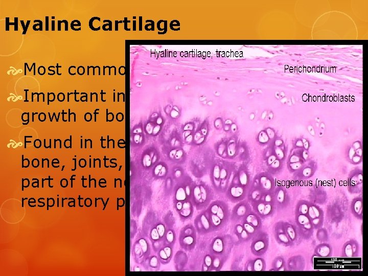Hyaline Cartilage Most common Important in the growth of bones Found in the ends