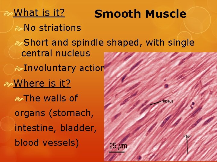  What is it? Smooth Muscle No striations Short and spindle shaped, with single