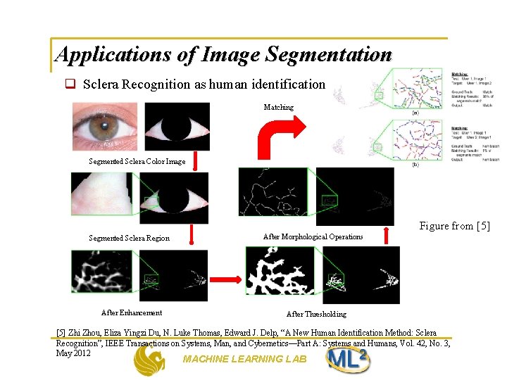 Applications of Image Segmentation q Sclera Recognition as human identification Matching Segmented Sclera Color