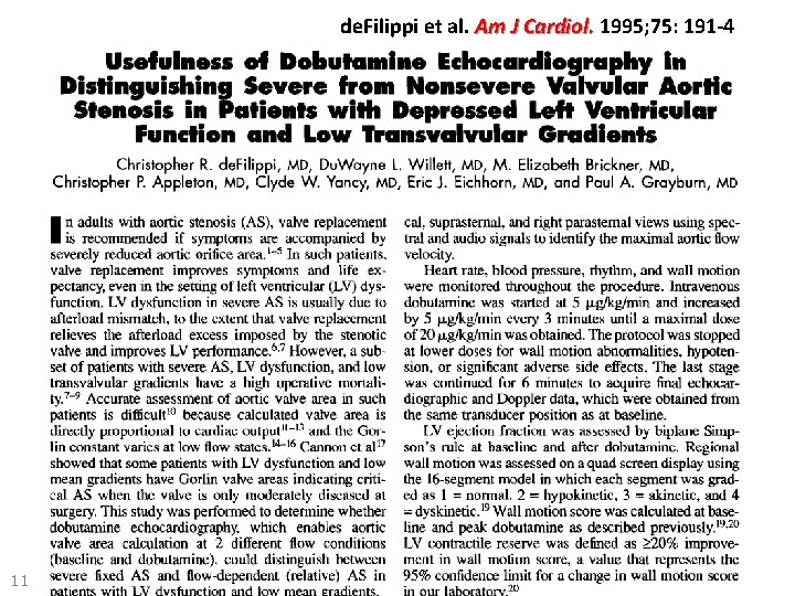 de. Filippi et al. Am J Cardiol. 1995; 75: 191 -4 11 de. Filippi et al. Am J Cardiol. 1995; 75: 191 -4 11
