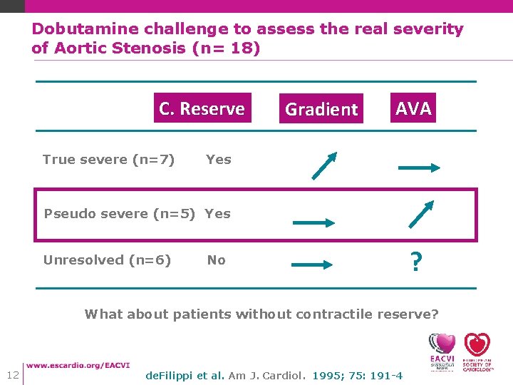 Dobutamine challenge to assess the real severity of Aortic Stenosis (n= 18) C. Reserve Dobutamine challenge to assess the real severity of Aortic Stenosis (n= 18) C. Reserve