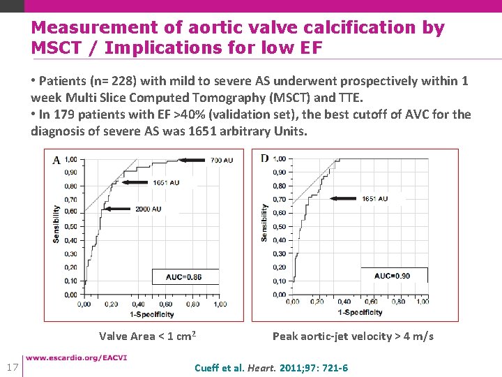 Measurement of aortic valve calcification by MSCT / Implications for low EF • Patients Measurement of aortic valve calcification by MSCT / Implications for low EF • Patients