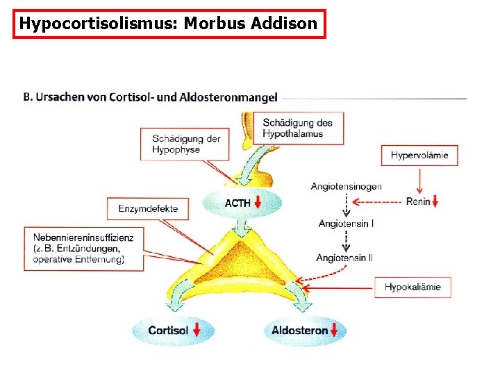 Hypocortisolismus: Morbus Addison 