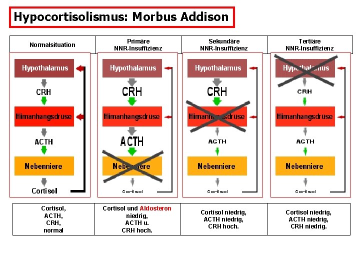 Hypocortisolismus: Morbus Addison Normalsituation Primäre NNR-Insuffizienz Sekundäre NNR-Insuffizienz Tertiäre NNR-Insuffizienz Cortisol, ACTH, CRH, normal