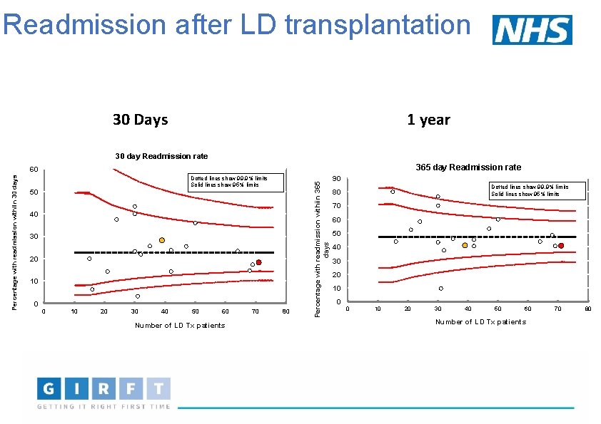 Readmission after LD transplantation 1 year 30 Days 30 day Readmission rate 365 day