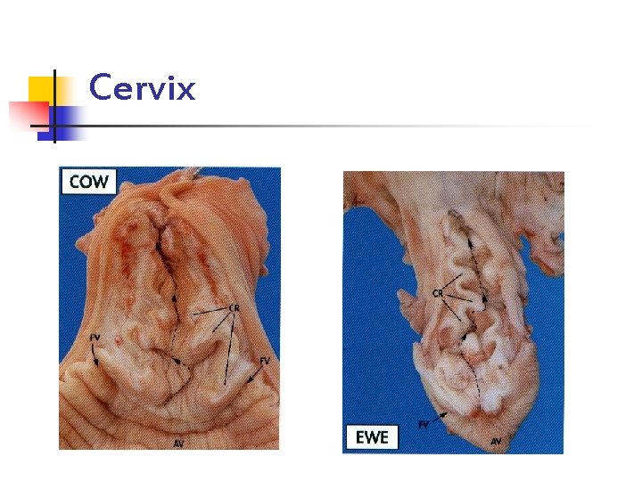 Cervix 