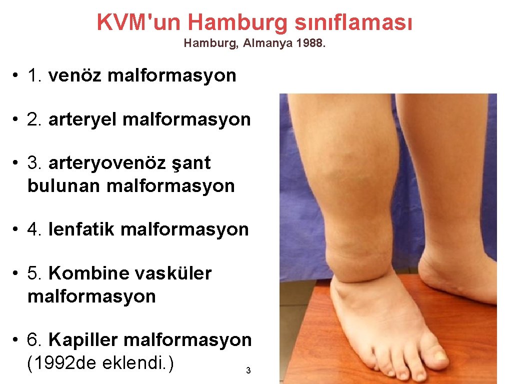 KVM'un Hamburg sınıflaması Hamburg, Almanya 1988. • 1. venöz malformasyon • 2. arteryel malformasyon