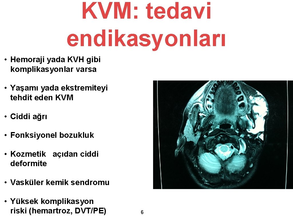 KVM: tedavi endikasyonları • Hemoraji yada KVH gibi komplikasyonlar varsa • Yaşamı yada ekstremiteyi