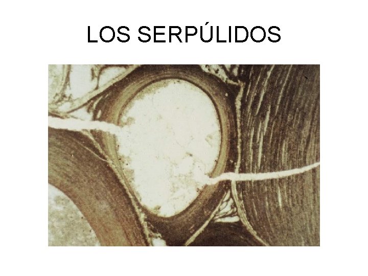 LOS SERPÚLIDOS 