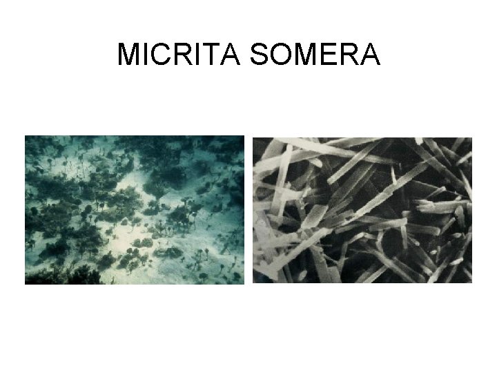 MICRITA SOMERA 
