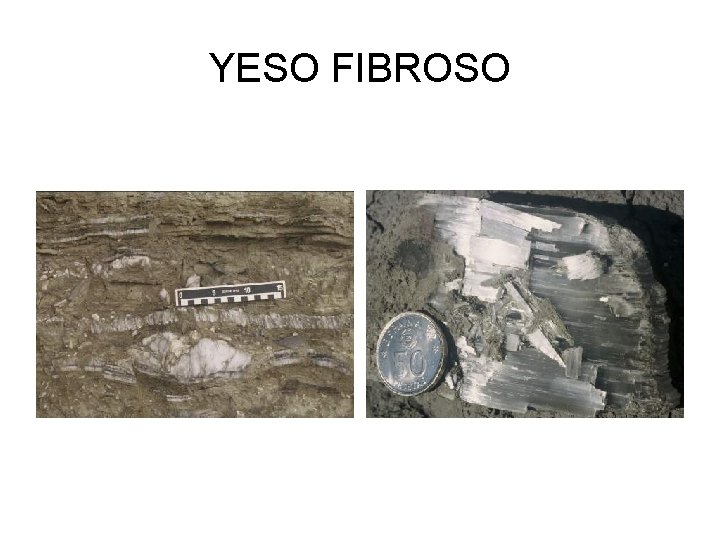 YESO FIBROSO 