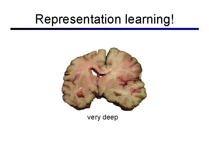 Representation learning! very deep 