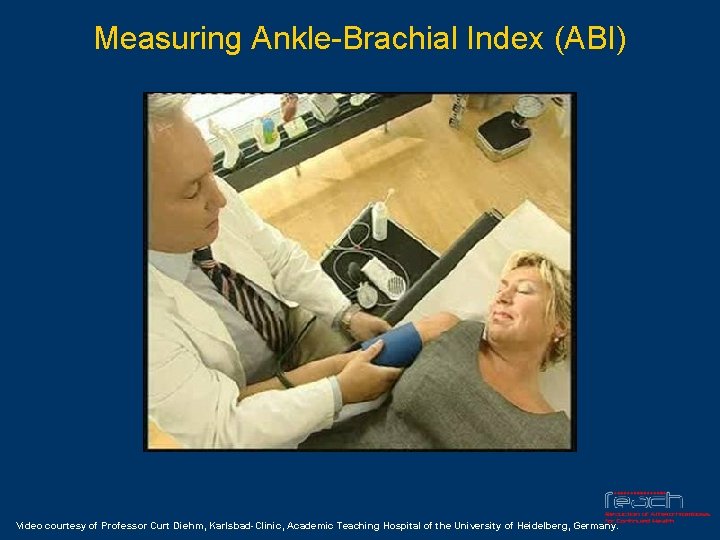 Measuring Ankle-Brachial Index (ABI) Video courtesy of Professor Curt Diehm, Karlsbad-Clinic, Academic Teaching Hospital