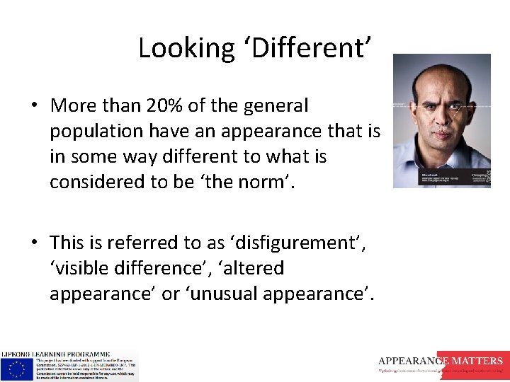 Looking ‘Different’ • More than 20% of the general population have an appearance that